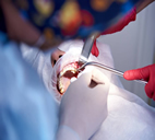 sinüs lifting uygulaması nedir