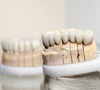 zirkonyum ve lamine diş uygulaması